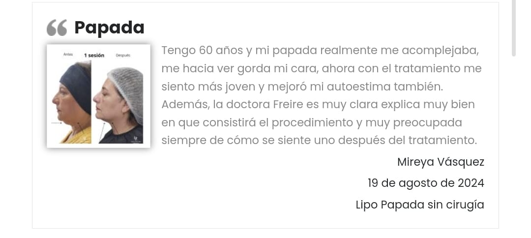 Lipopapada enzimática sin Cirugía