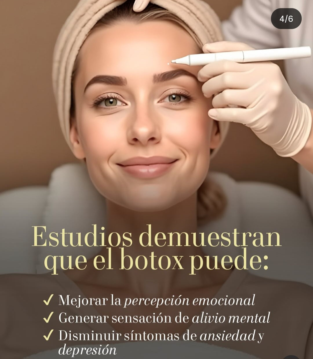 Reducción de arrugas tercio superior rostro frente, entrecejo y "patas de gallo"